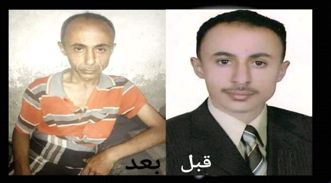 
                     شاهد كيف ظهر الصحفي القادري بعد الإفراج عنه من سجون الحوثي؟