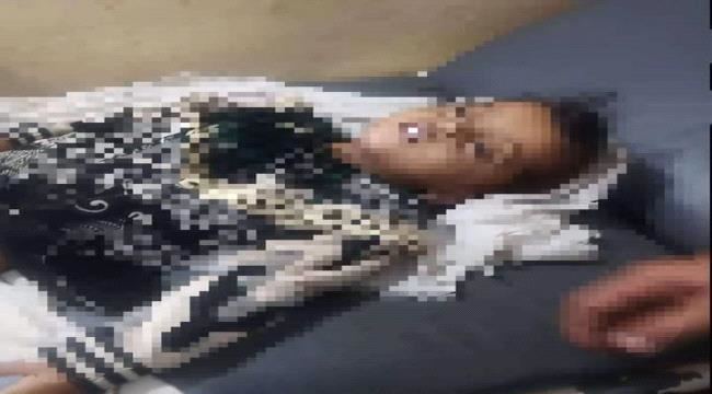 
                     وفاة طفلة في محافظة لحج بسبب أرجوحة - تفاصيل
